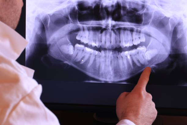 Best Teeth Whitening  in Park City, TN